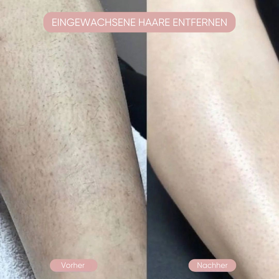 Belvora Intimrasierer 2-in-1