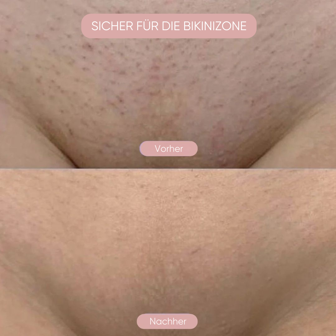 Belvora Intimrasierer 2-in-1