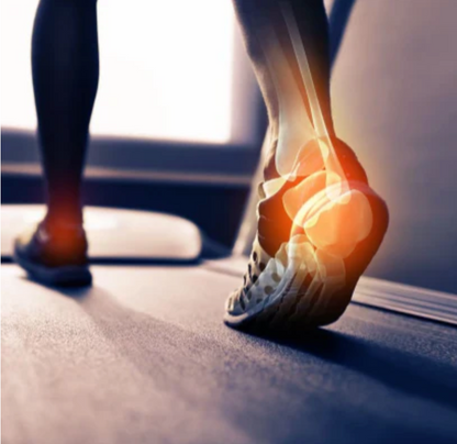 Gepolsterte Fußgewölbestütze gegen Plantarfasziitis & Plattfuß (1 Paar)