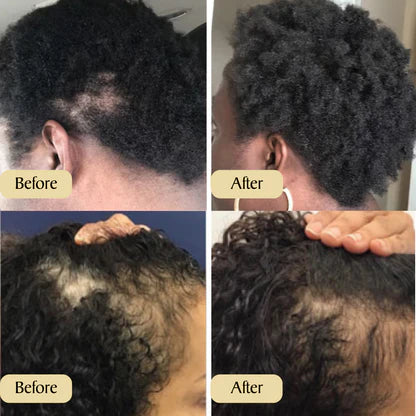 Vevenchy: Deine natürliche Ölbehandlung für Haarwachstum (1+1 Gratis)