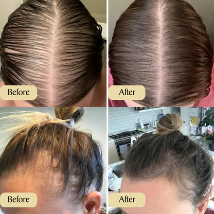 Vevenchy: Deine natürliche Ölbehandlung für Haarwachstum (1+1 Gratis)