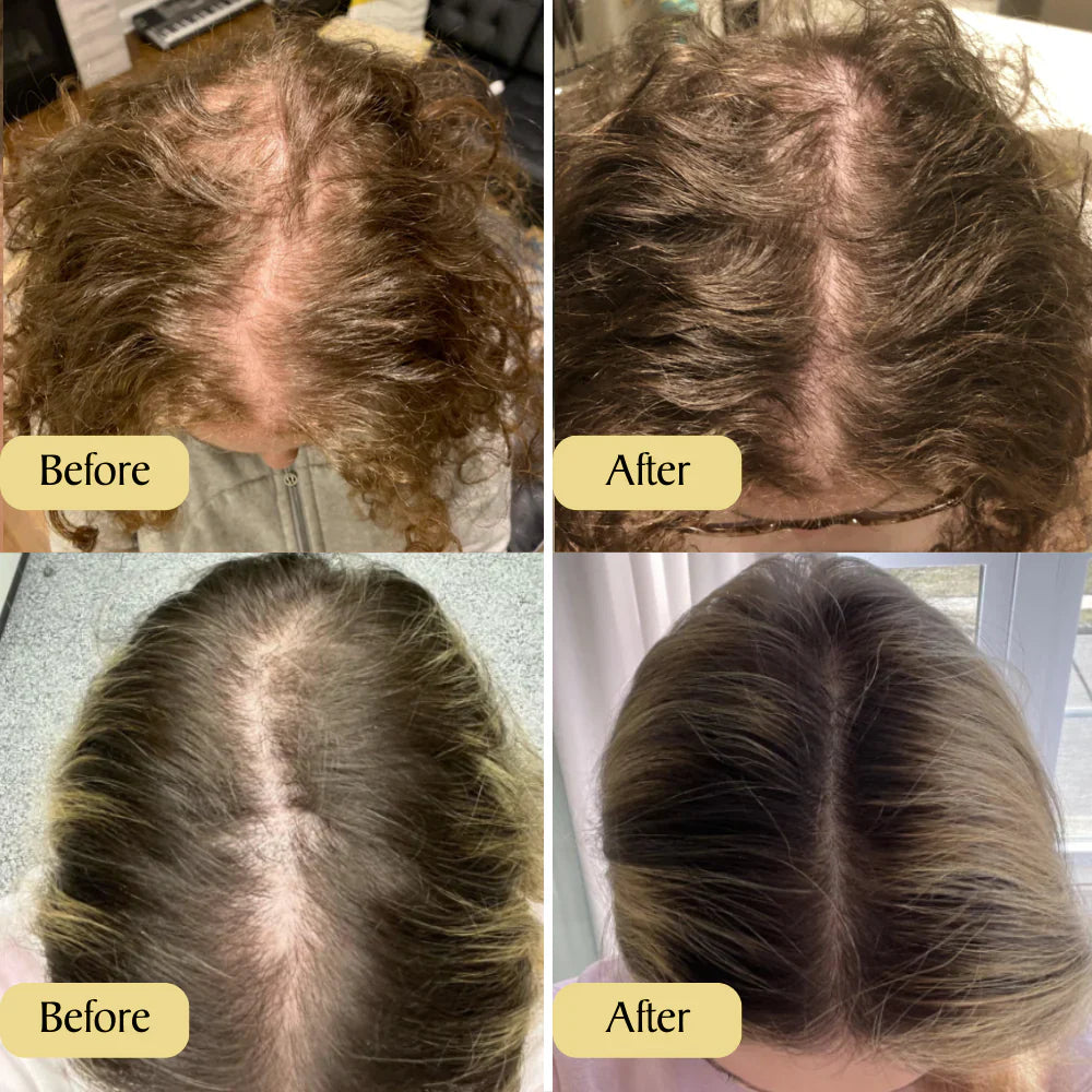 Vevenchy: Deine natürliche Ölbehandlung für Haarwachstum (1+1 Gratis)